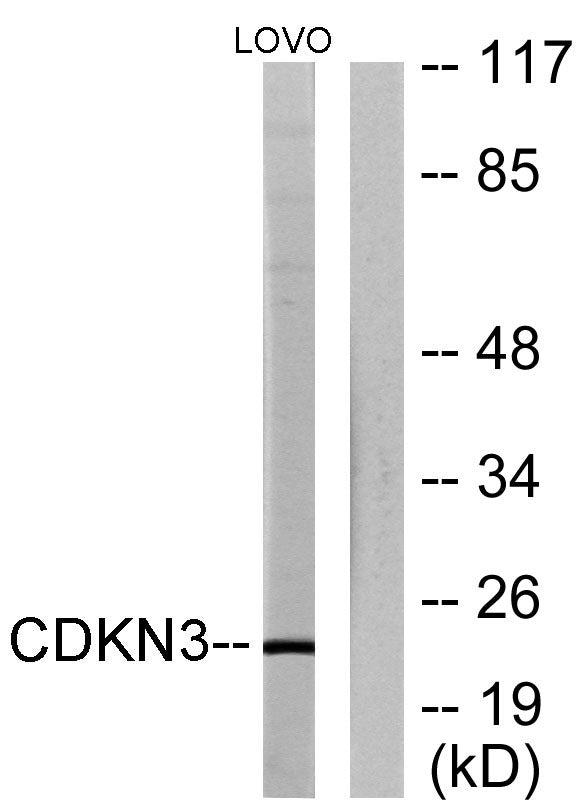 CDKN3 Rabbit Polyclonal Antibody
