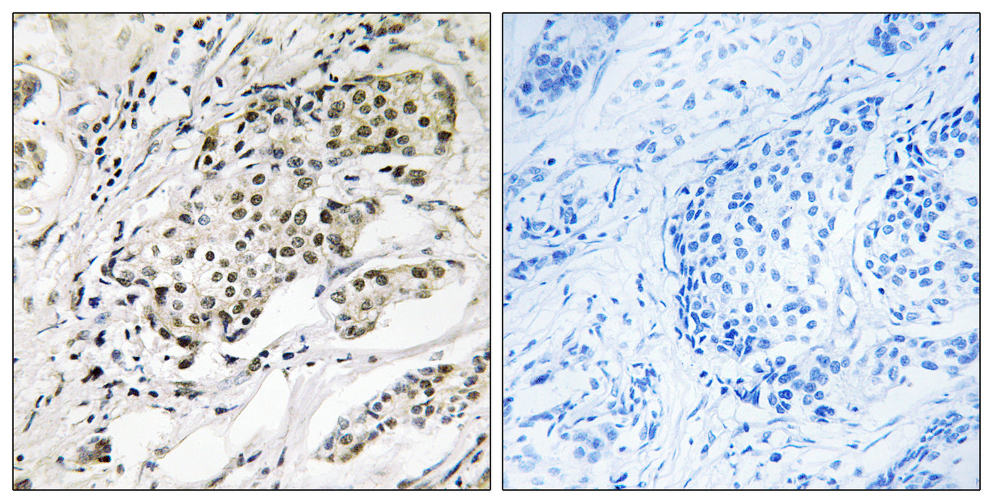 CDYL2 Rabbit Polyclonal Antibody