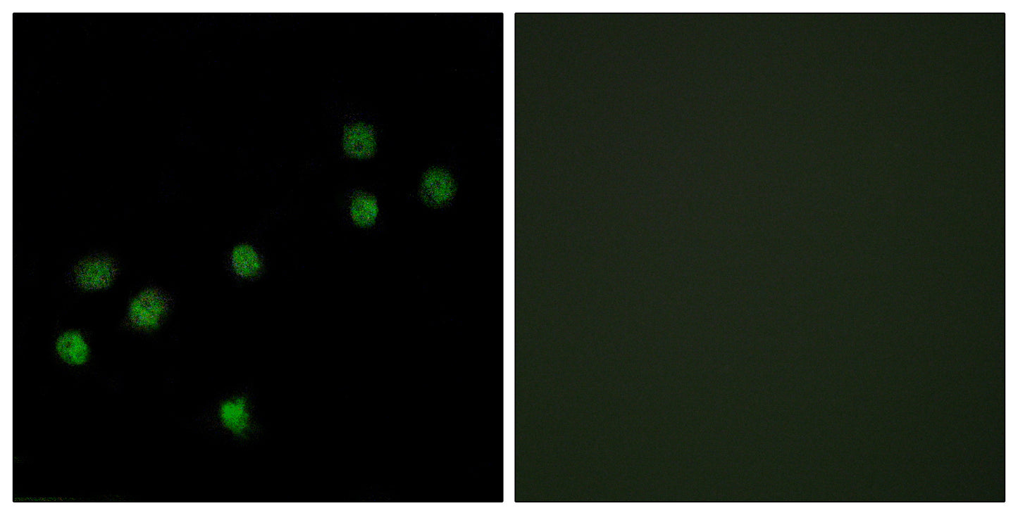 CENP-A Rabbit Polyclonal Antibody