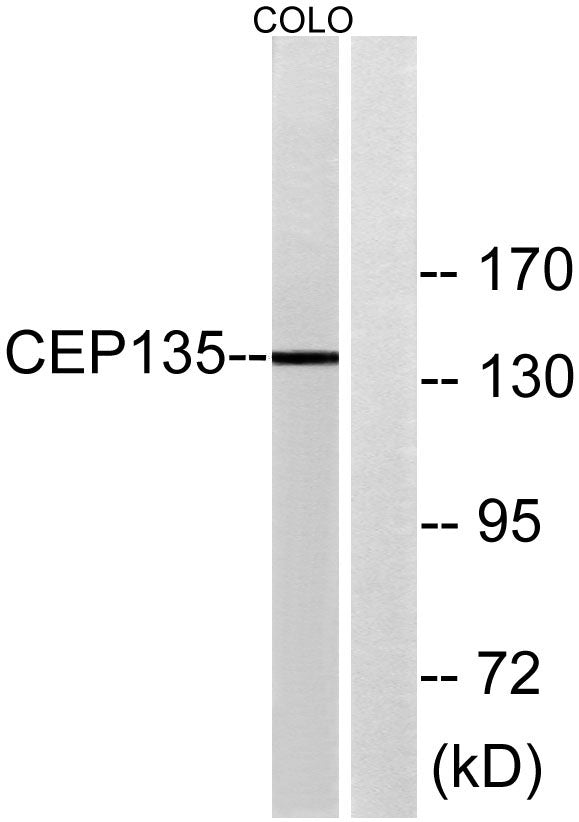 CEP135 Rabbit Polyclonal Antibody