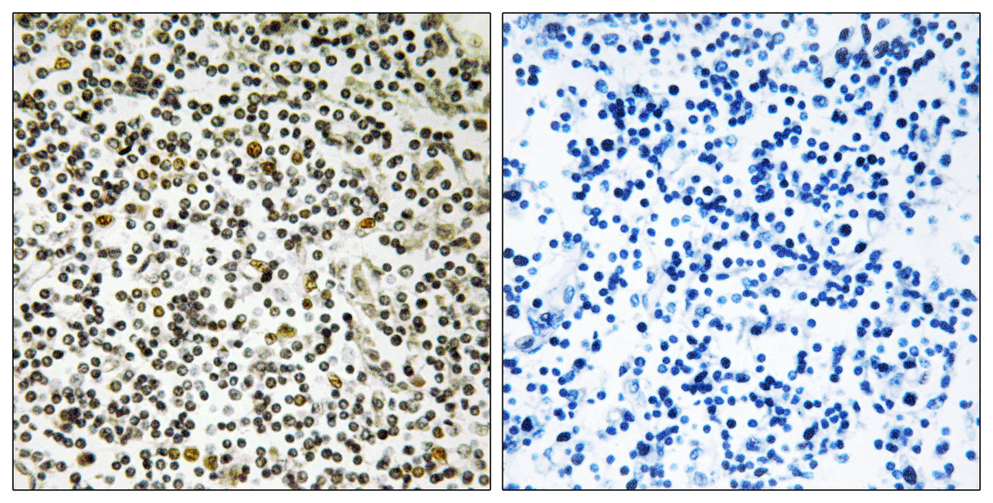 CEP152 Rabbit Polyclonal Antibody