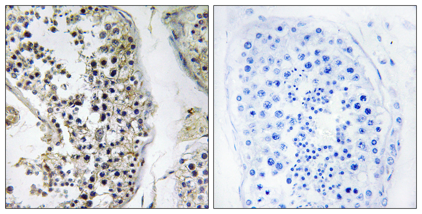 CEP170 Rabbit Polyclonal Antibody