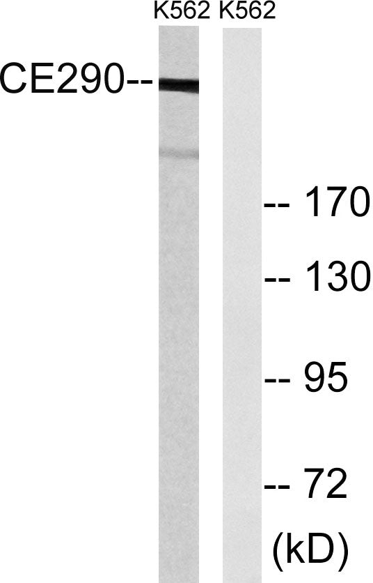 CEP290 Rabbit Polyclonal Antibody