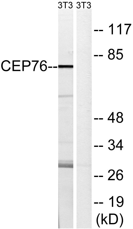 CEP76 Rabbit Polyclonal Antibody