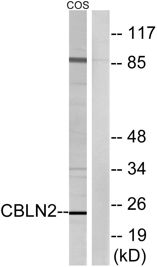 Cerebellin 2 Rabbit Polyclonal Antibody