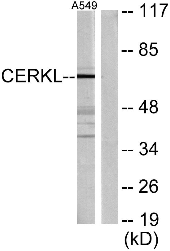 CERKL Rabbit Polyclonal Antibody
