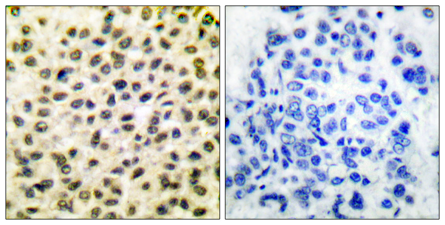 c-Fos Rabbit Polyclonal Antibody