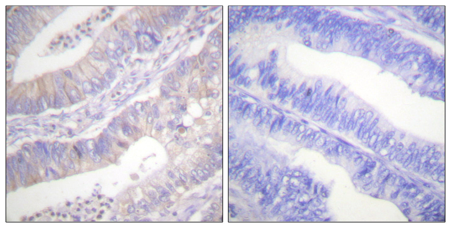 CFTR Rabbit Polyclonal Antibody