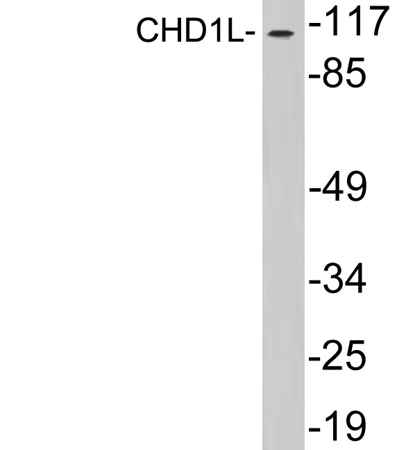 CHD1L Rabbit Polyclonal Antibody
