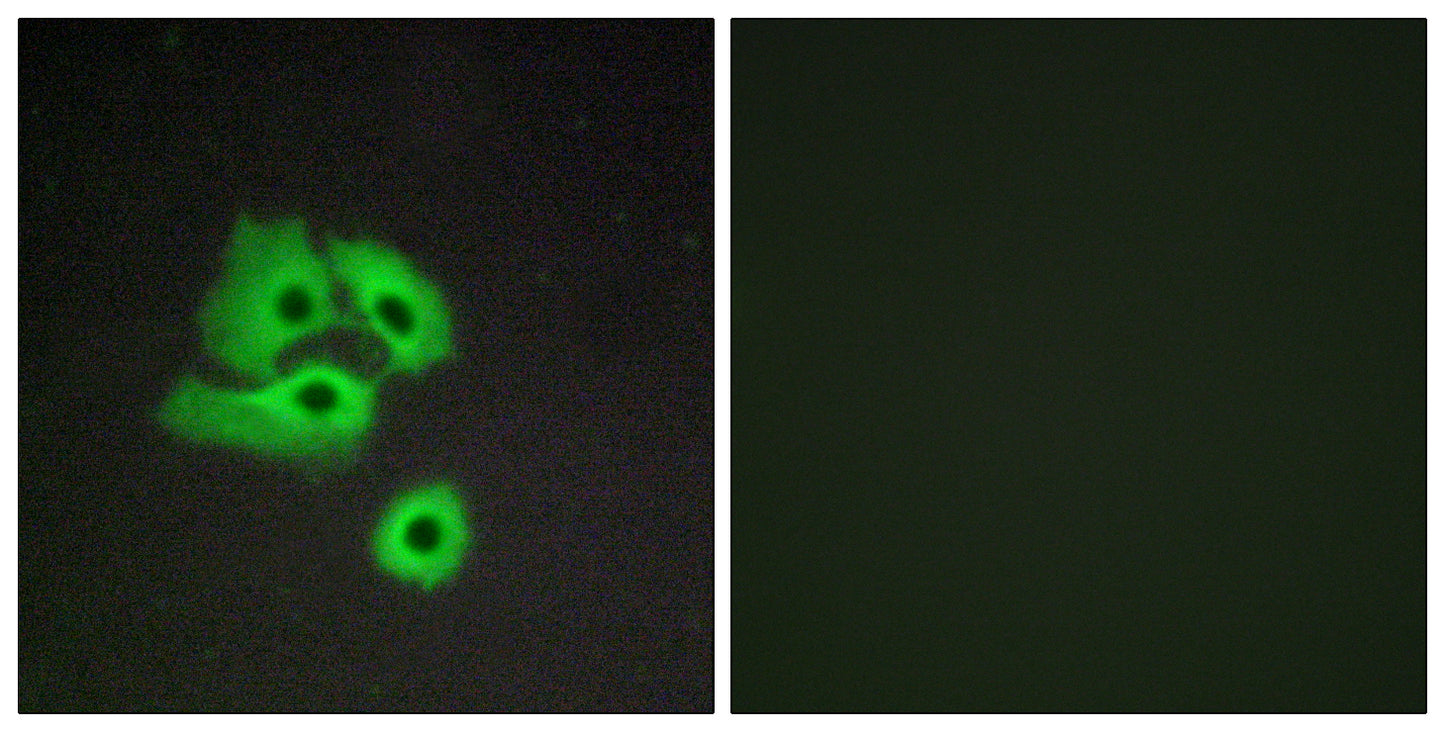 Chemokine Receptor D6 Rabbit Polyclonal Antibody