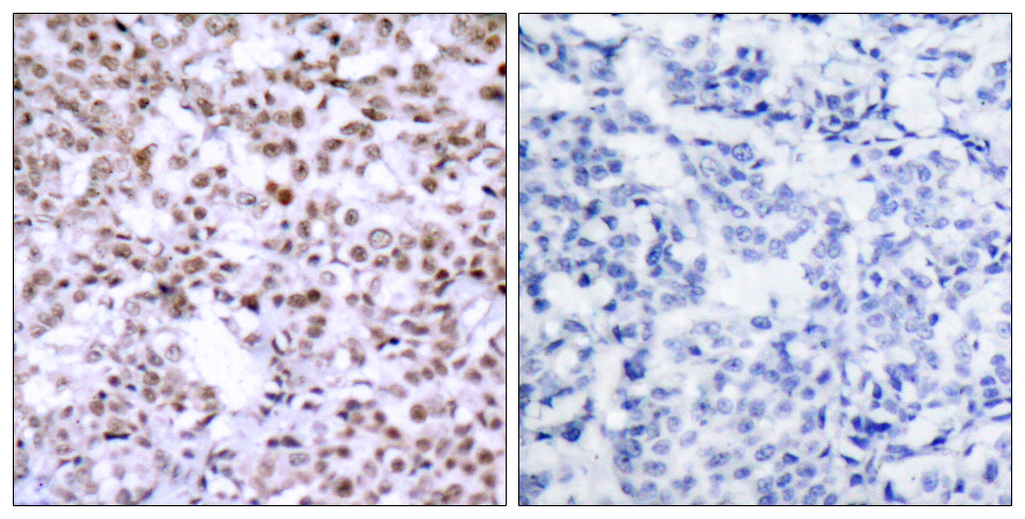 Chk2 Rabbit Polyclonal Antibody