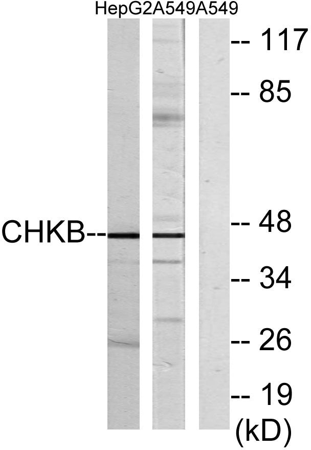 ChoKB Rabbit Polyclonal Antibody