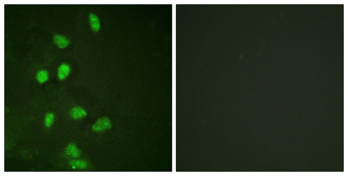 CHOP Rabbit Polyclonal Antibody