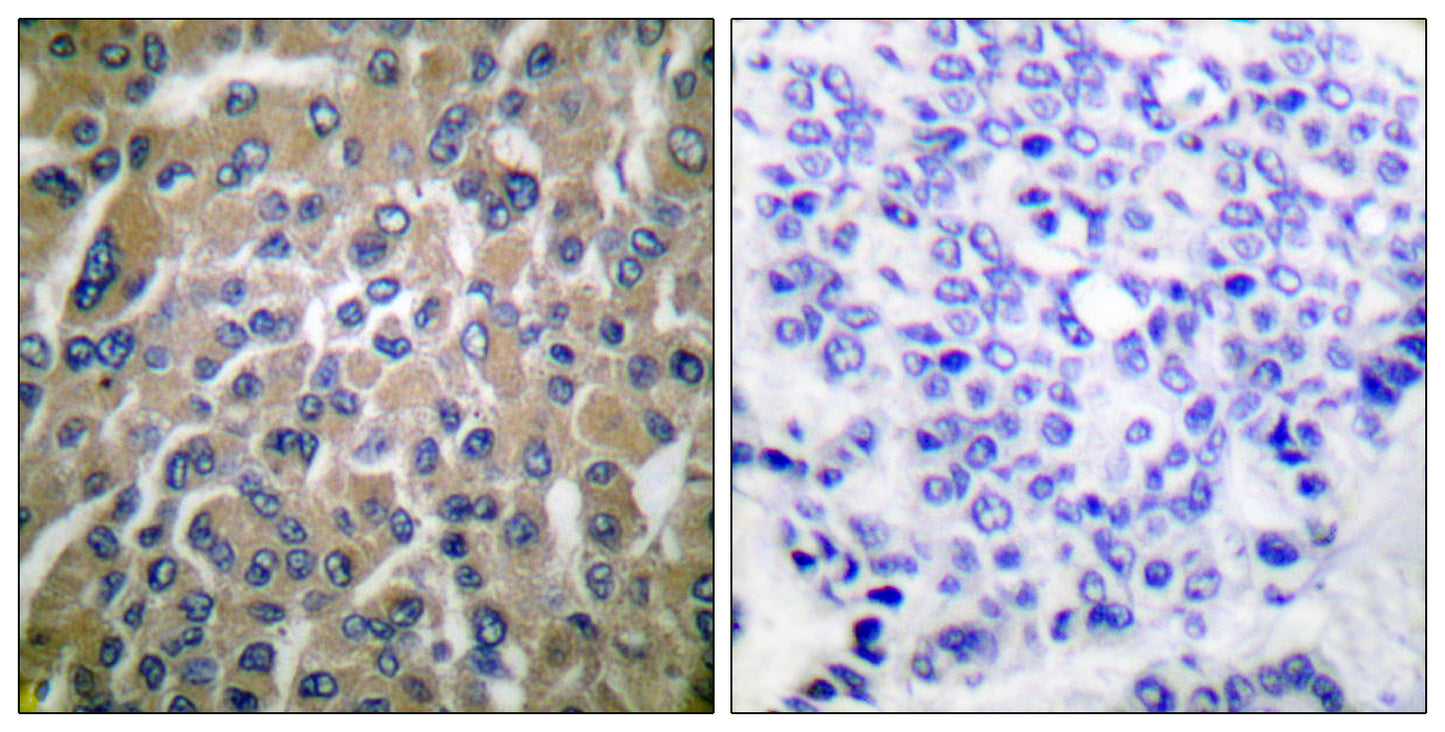 Choriogonadotropin β Rabbit Polyclonal Antibody