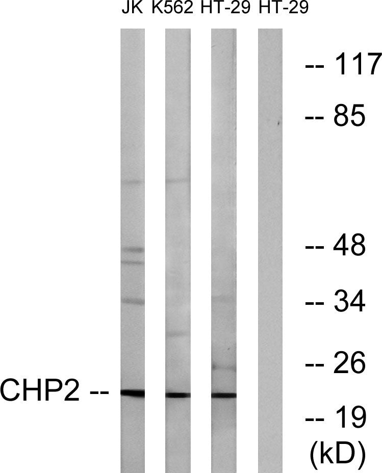 CHP2 Rabbit Polyclonal Antibody