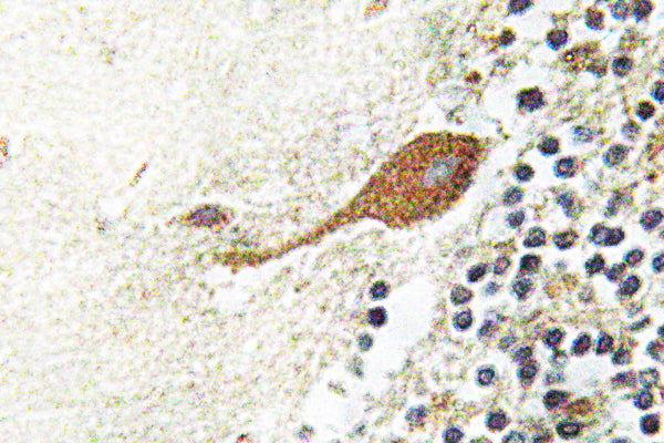 Chr-A Rabbit Polyclonal Antibody