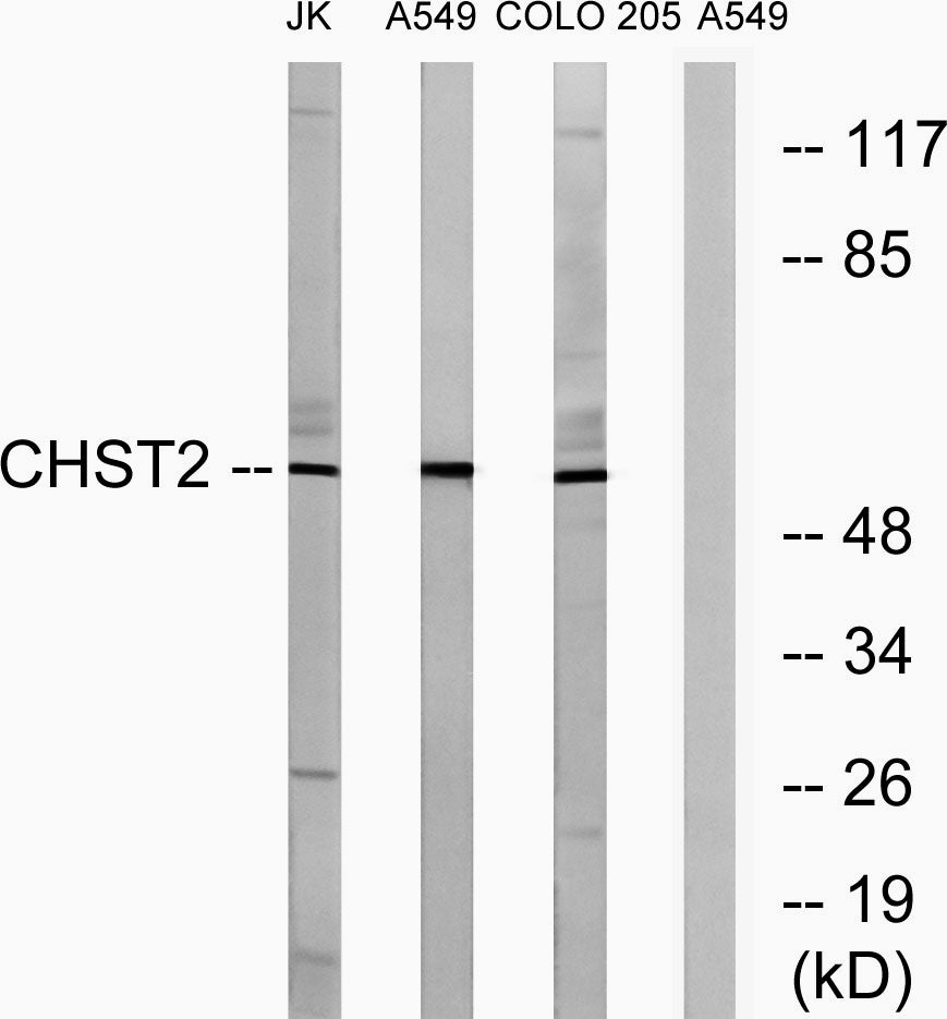 CHST2 Rabbit Polyclonal Antibody