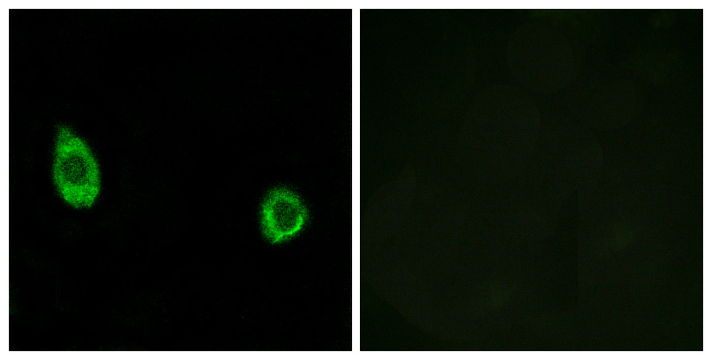 CHST9 Rabbit Polyclonal Antibody