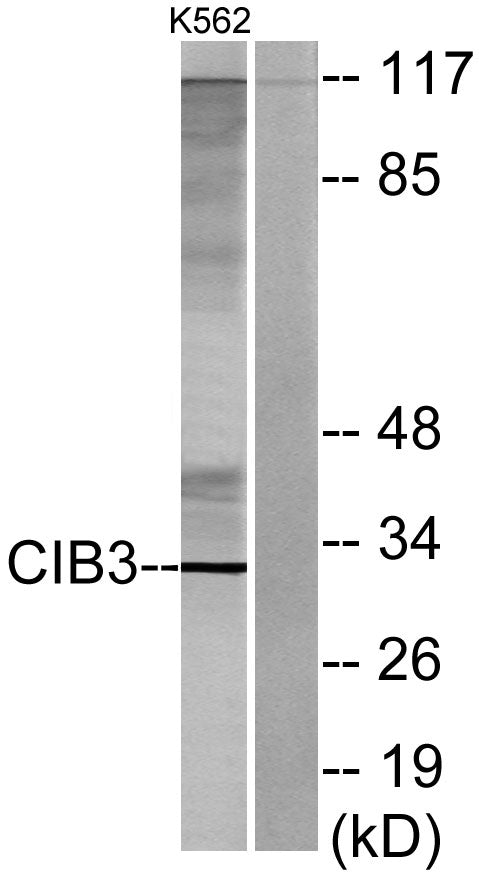 CIB3 Rabbit Polyclonal Antibody