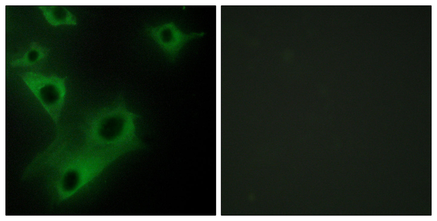 CIDE-3 Rabbit Polyclonal Antibody
