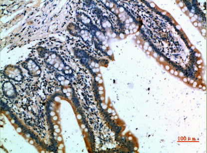 CKR-1 Rabbit Polyclonal Antibody