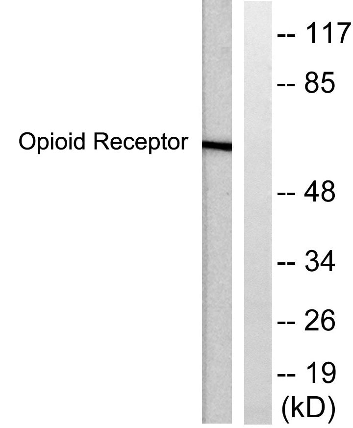 CKR-5 Rabbit Polyclonal Antibody