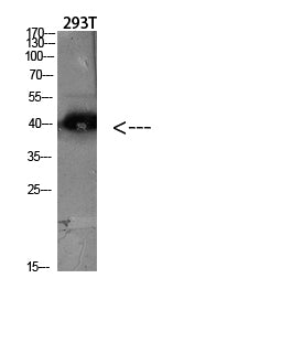 CKR-5 Rabbit Polyclonal Antibody