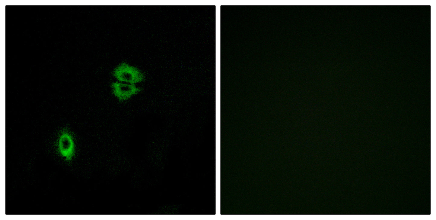 CKR-7 Rabbit Polyclonal Antibody