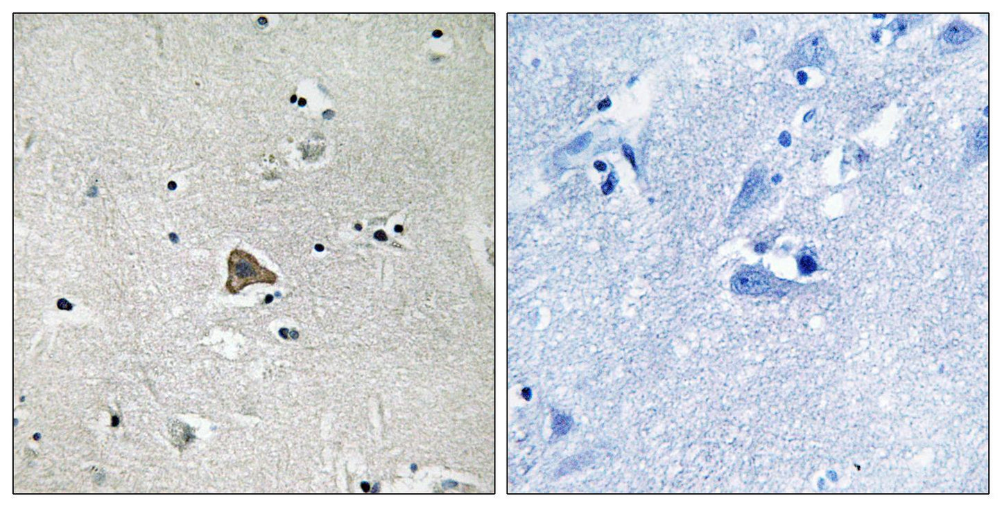 Claudin-4 Rabbit Polyclonal Antibody