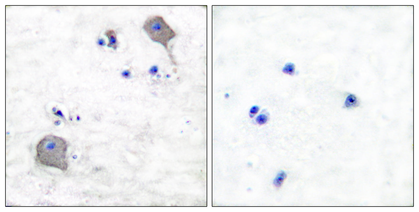 Claudin-5 Rabbit Polyclonal Antibody