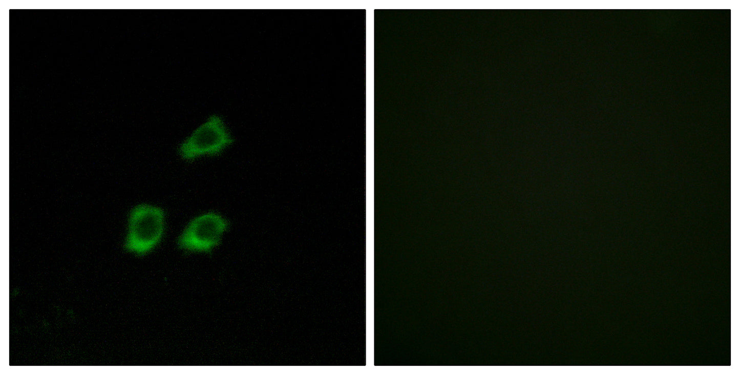 CLC-4 Rabbit Polyclonal Antibody