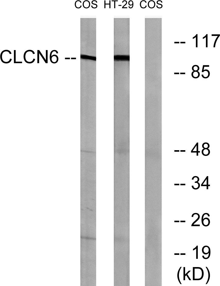 CLC-6 Rabbit Polyclonal Antibody