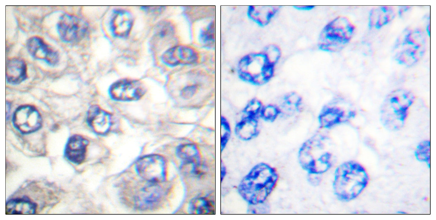 Cleaved-Bad (D71) Rabbit Polyclonal Antibody