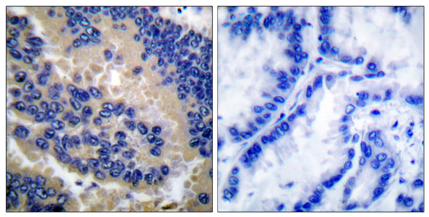Cleaved-Caspase-3 p17 (D175) Rabbit Polyclonal Antibody