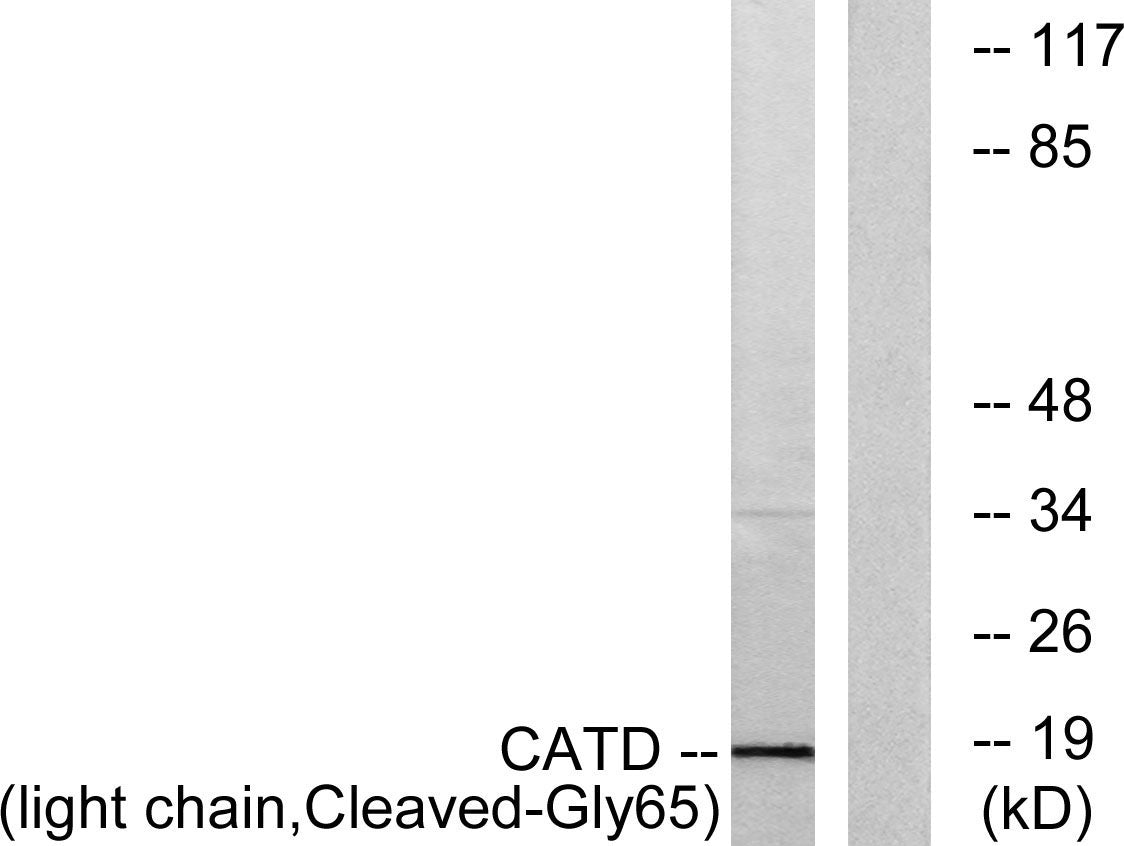 Cleaved-Cathepsin D LC (G65) Rabbit Polyclonal Antibody