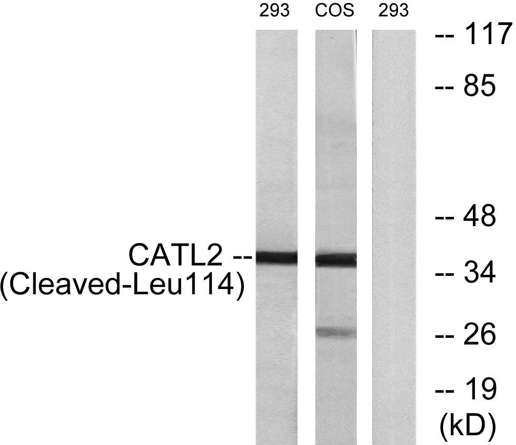 Cleaved-Cathepsin L2 (L114) Rabbit Polyclonal Antibody