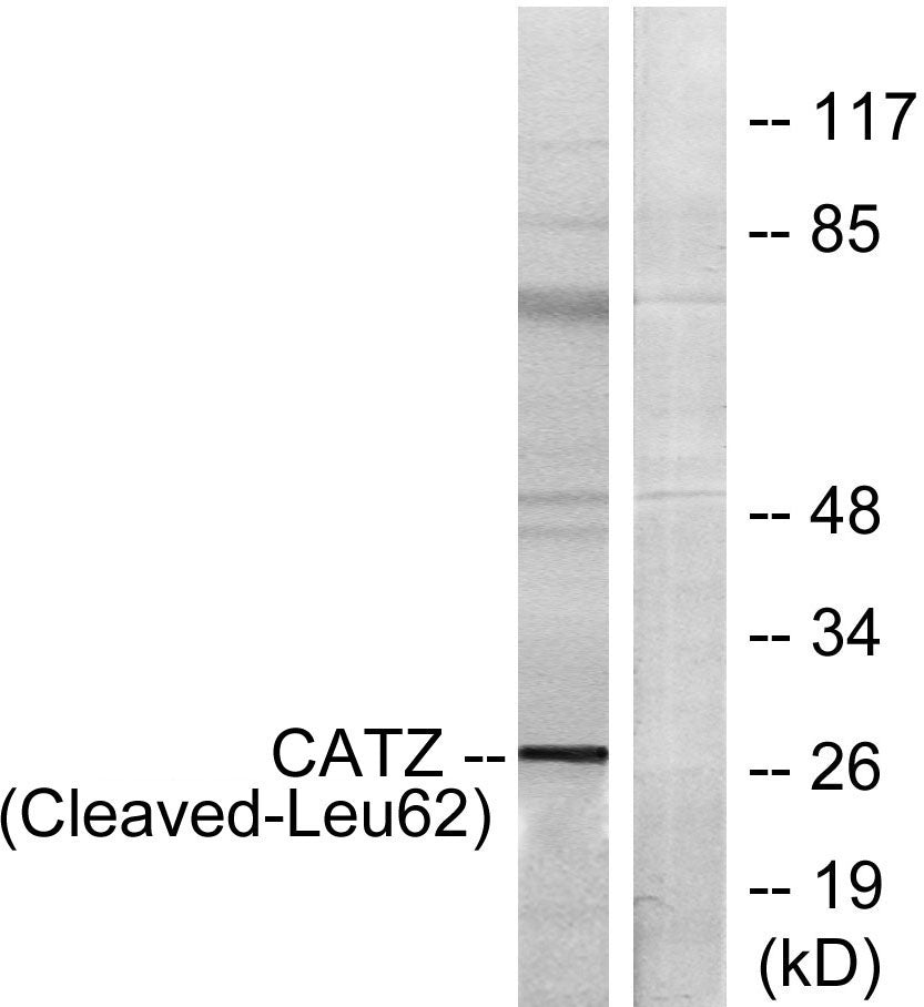 Cleaved-Cathepsin Z (L62) Rabbit Polyclonal Antibody