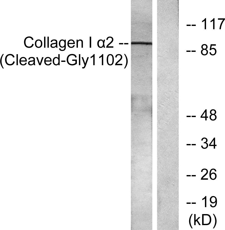 Cleaved-COL1A2 (G1102) Rabbit Polyclonal Antibody