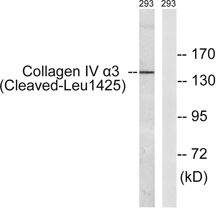Cleaved-COL4A3 (L1425) Rabbit Polyclonal Antibody