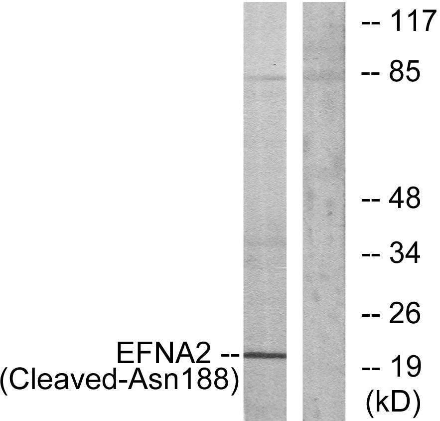 Cleaved-Ephrin-A2 (N188) Rabbit Polyclonal Antibody