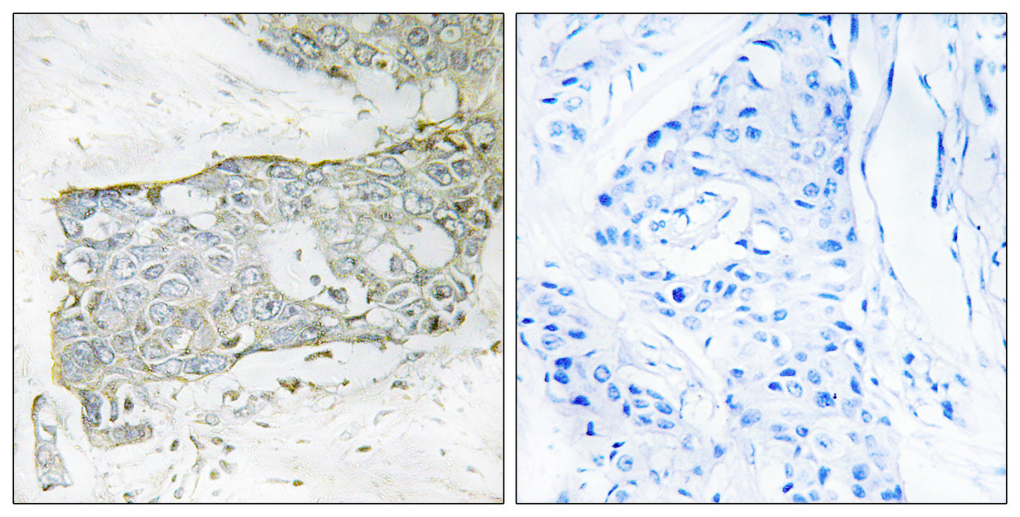 Cleaved-Factor VII LC (R212) Rabbit Polyclonal Antibody