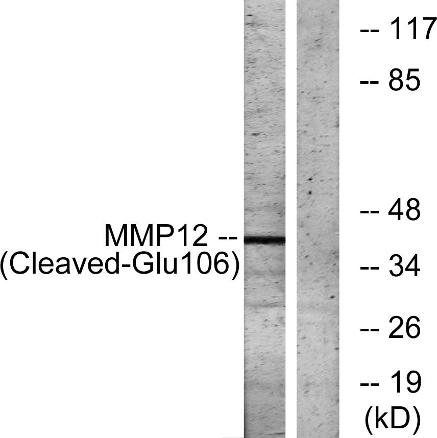 Cleaved-MMP-12 (G106) Rabbit Polyclonal Antibody