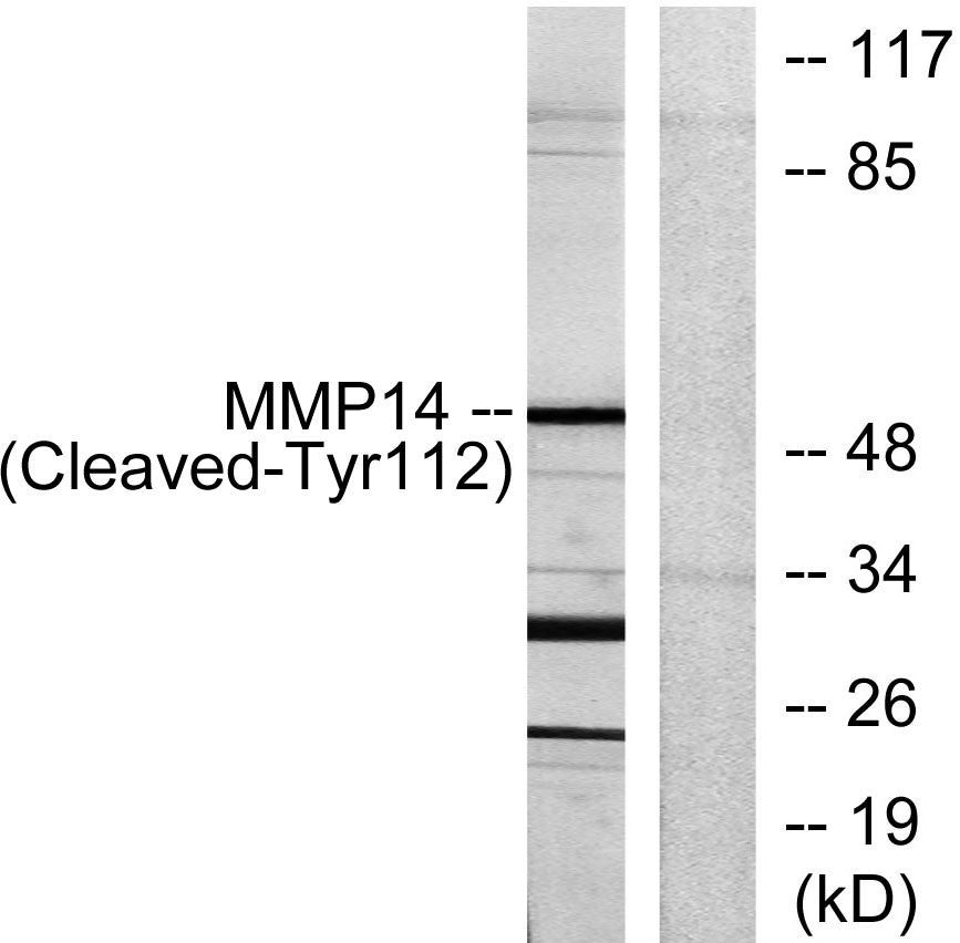 Cleaved-MMP-14 (Y112) Rabbit Polyclonal Antibody