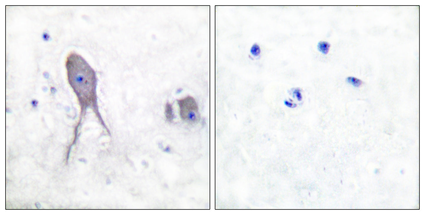 Cleaved-Notch 2 (D1733) Rabbit Polyclonal Antibody