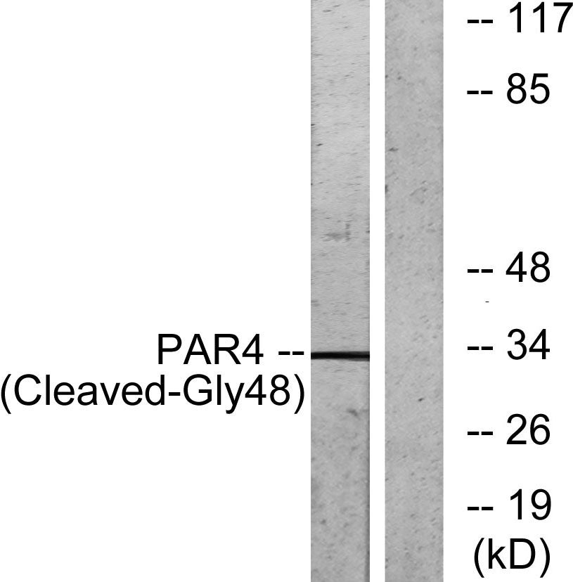 Cleaved-PAR-4 (G48) Rabbit Polyclonal Antibody