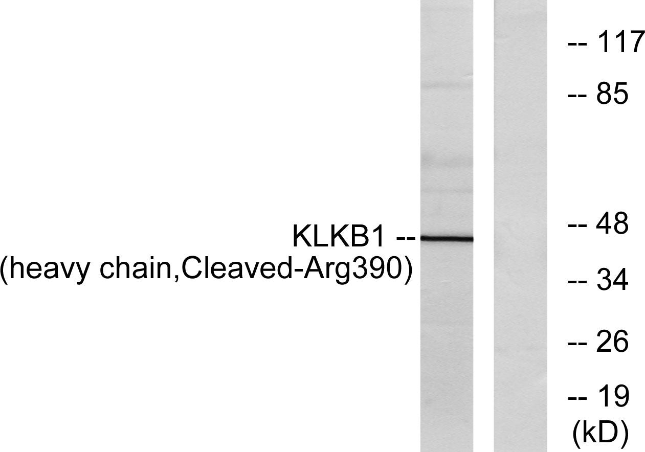 Cleaved-Plasma Kallikrein HC (R390) Rabbit Polyclonal Antibody