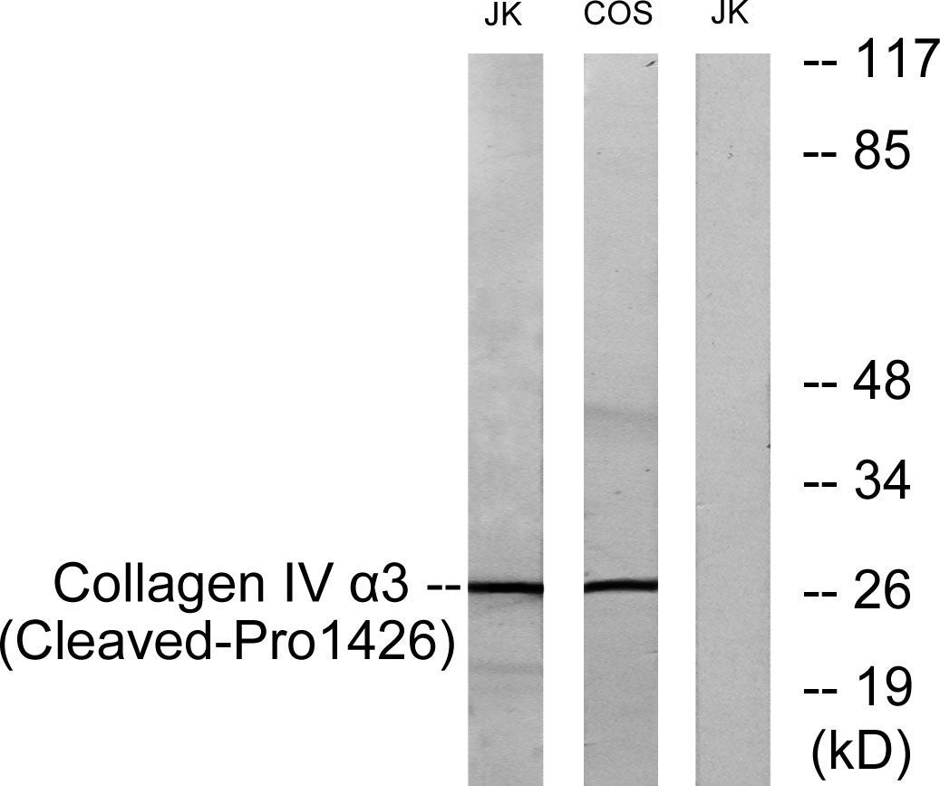 Cleaved-Tumstatin (P1426) Rabbit Polyclonal Antibody