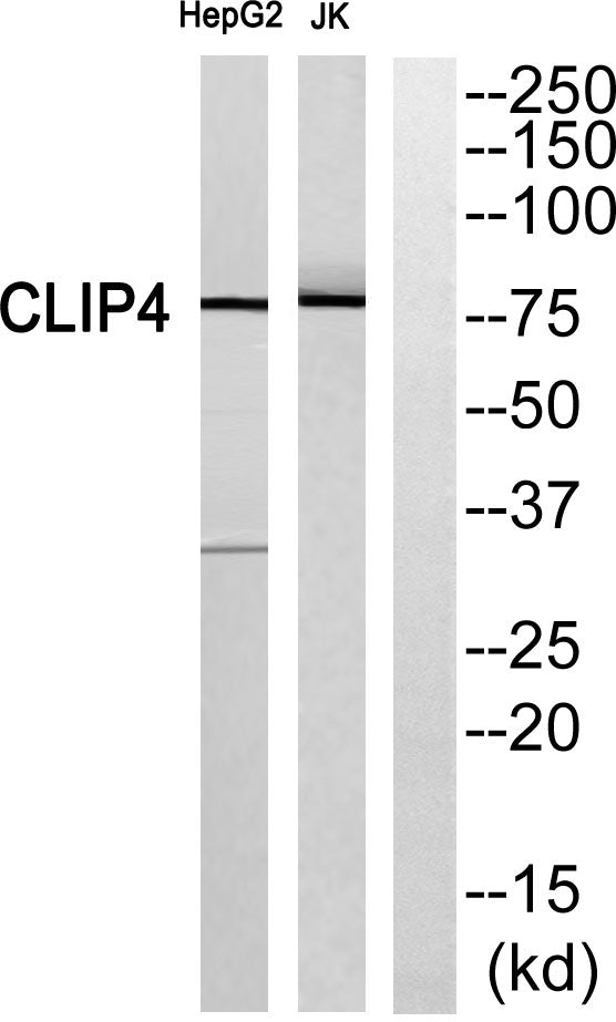 CLIP4 Rabbit Polyclonal Antibody