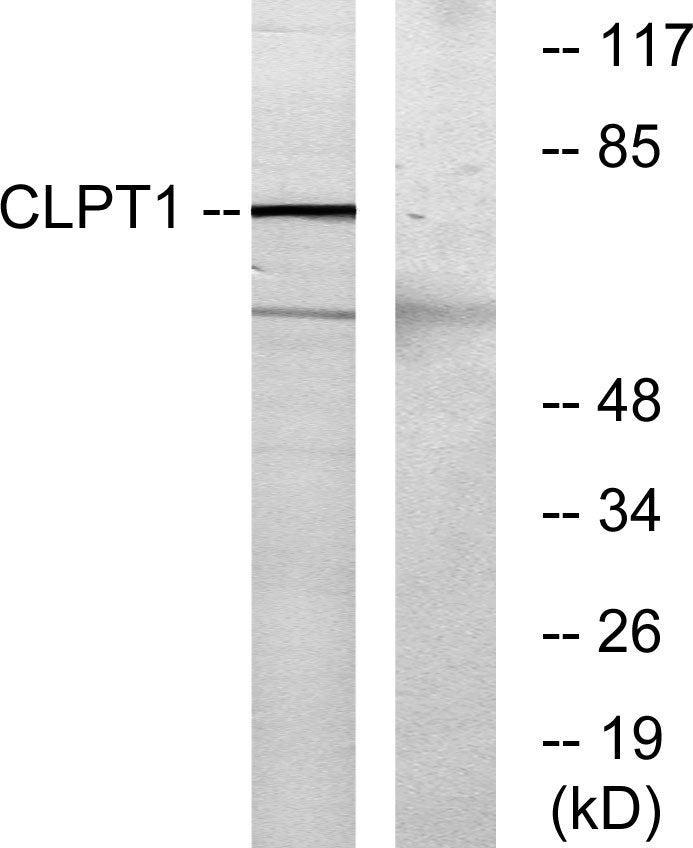 CLPTM1 Rabbit Polyclonal Antibody