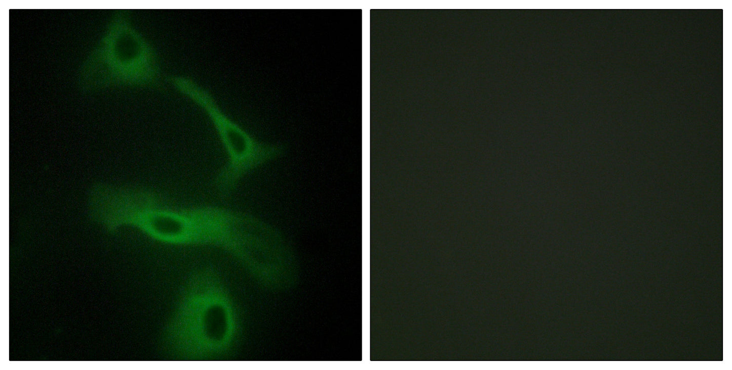 Clusterin Rabbit Polyclonal Antibody